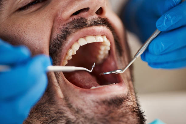Best Emergency Dental Services for Seniors in Anton, TX